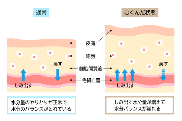 腎機能を高める食事