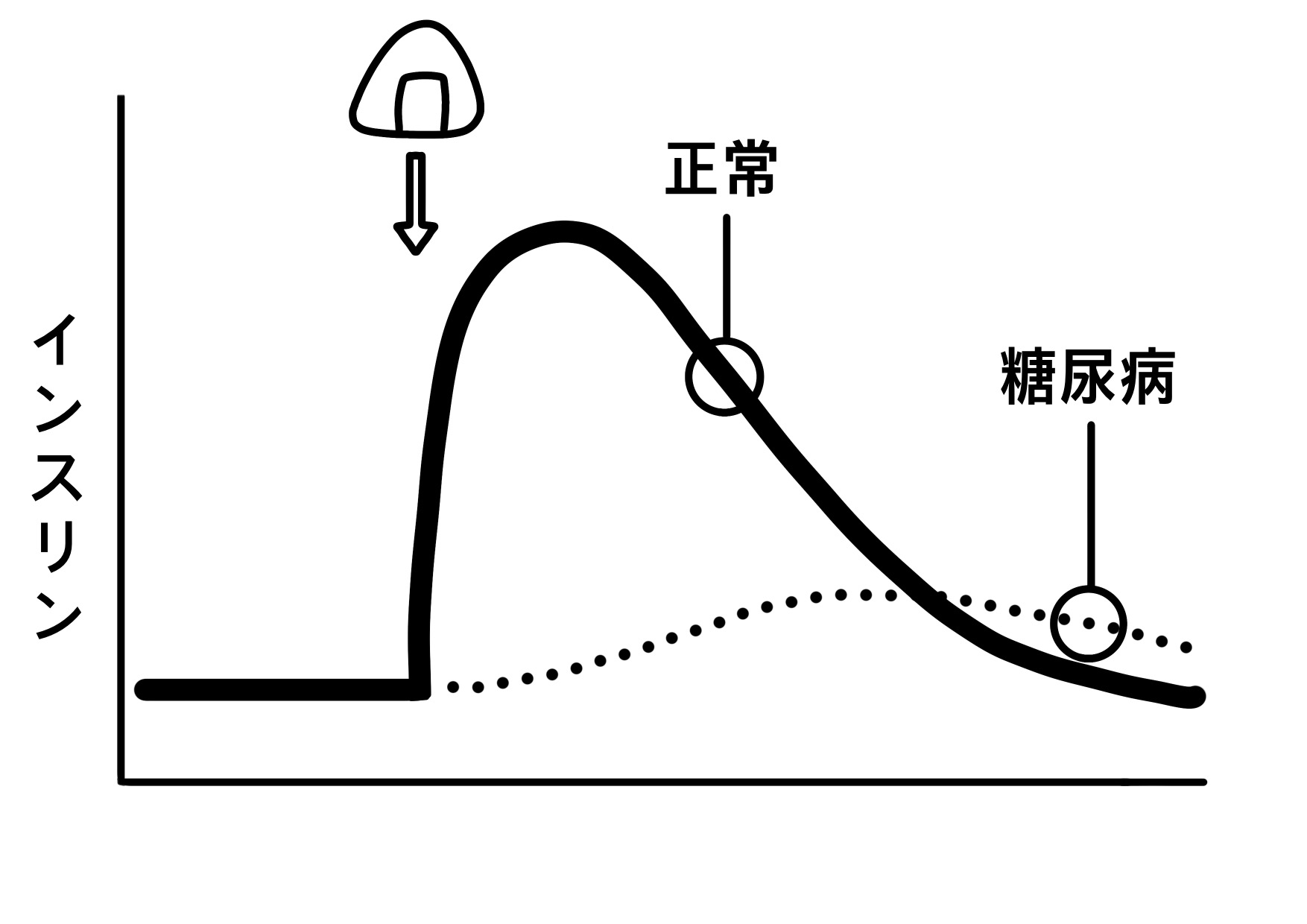 血糖スパイクがおこる理由と糖尿病